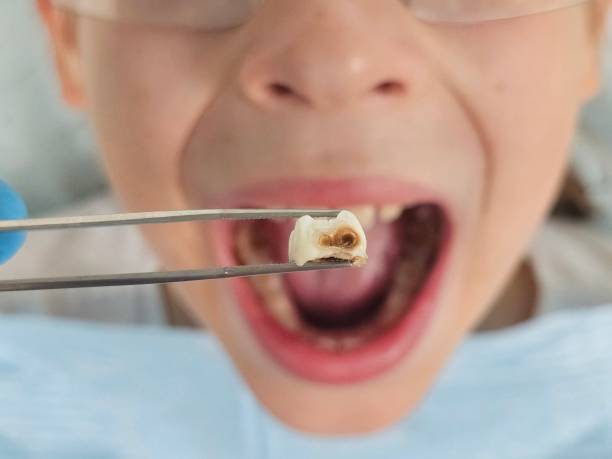 Best Emergency Pediatric Dentist  in Montrose, PA