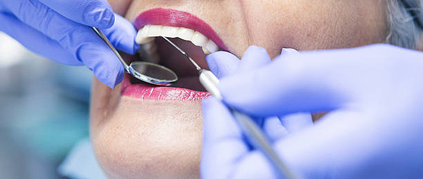 Best Chipped Tooth Repair Near Me  in Montrose, PA